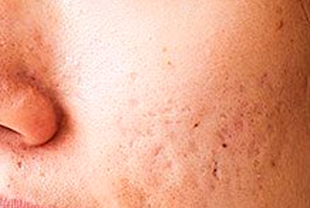 Dull Skin